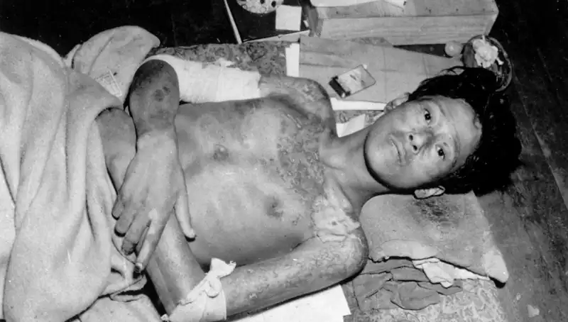80 Yıl Sonra Nagasaki’den Nükleer Felaket Uyarısı ve Küresel Endişe