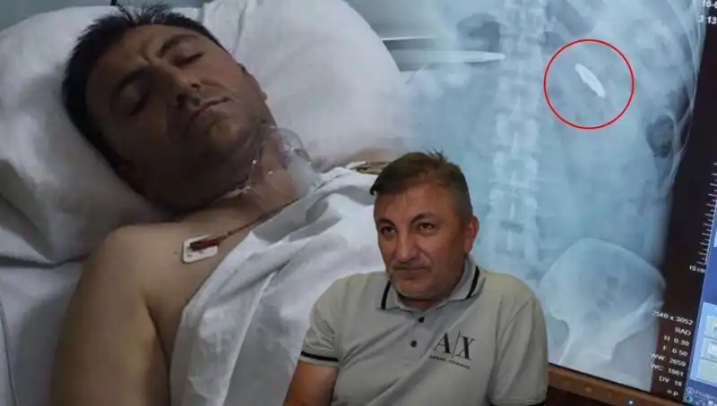 15 Temmuz'un Gölgesinde: Kurşunla Yaralanmış Hayatlar ve Umut