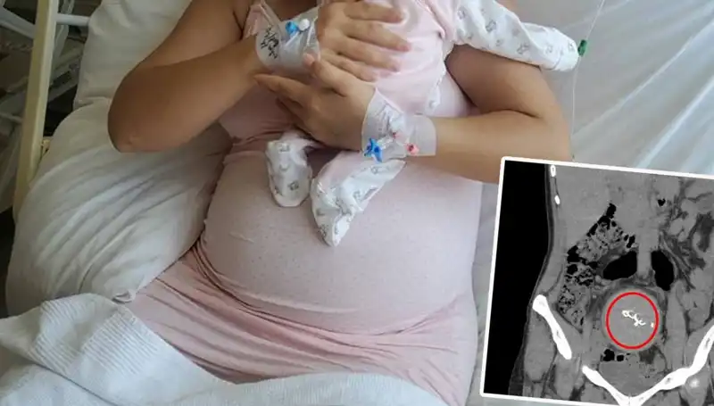 Doğumda Unutulan Bebek İki Yıl Sonra Ortaya Çıktı! Sadece Bir Gazlı Bez Yeter Mi?